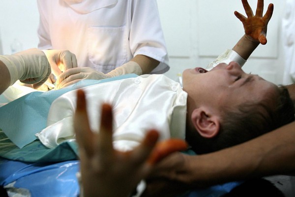 Ilustrasi sunat pada anak (Foto:GettyImages via Indpendent.co.uk)
