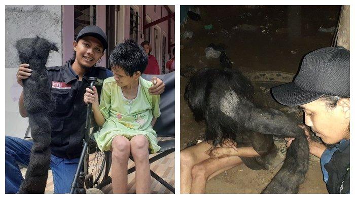 Sukiyah, perempuan yang rambutnya jadi sarang tikus dan kecoak serta bangkai (tribunews)