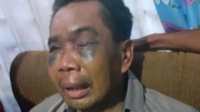 Sarpan, disiksa polisi (SinarLampung)
