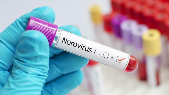 Ilustrasi norovirus. (iStockphoto/jarun011)